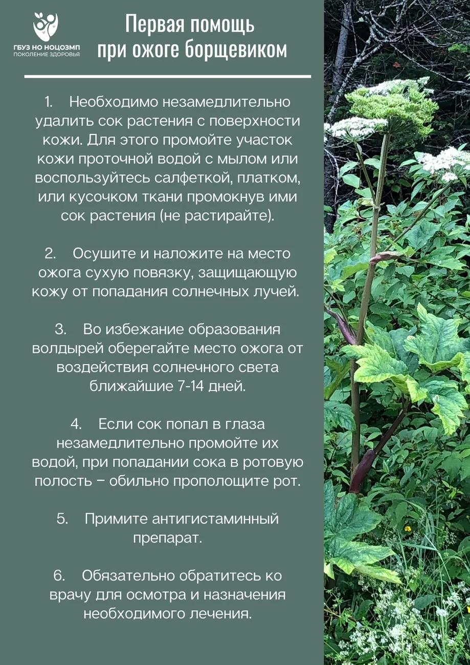 Ожог борщевиком